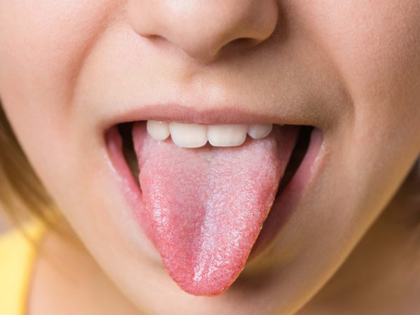 13 choses que votre langue révèle au sujet de votre santé ...